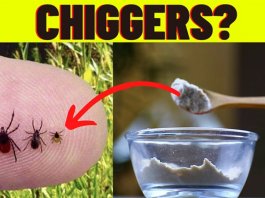 How to Get Rid of Chiggers in Your Yard in 2021