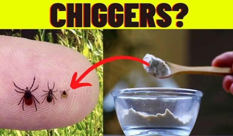 How To Easy Get Rid Of Chiggers In Your Yard In 2022   How To Get Rid Of Chiggers In Your Yard 768x449 