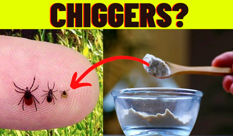 How To Get Rid Of Chiggers In Your Yard 